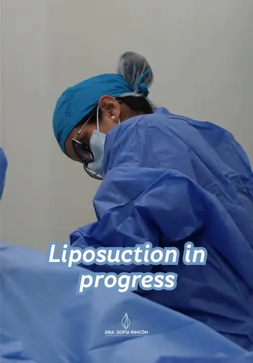 Arm lipo results video