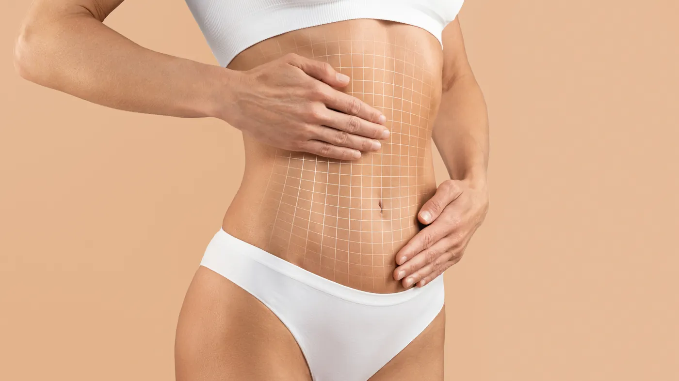 Lipoescultura con abdominoplastia en Tijuana