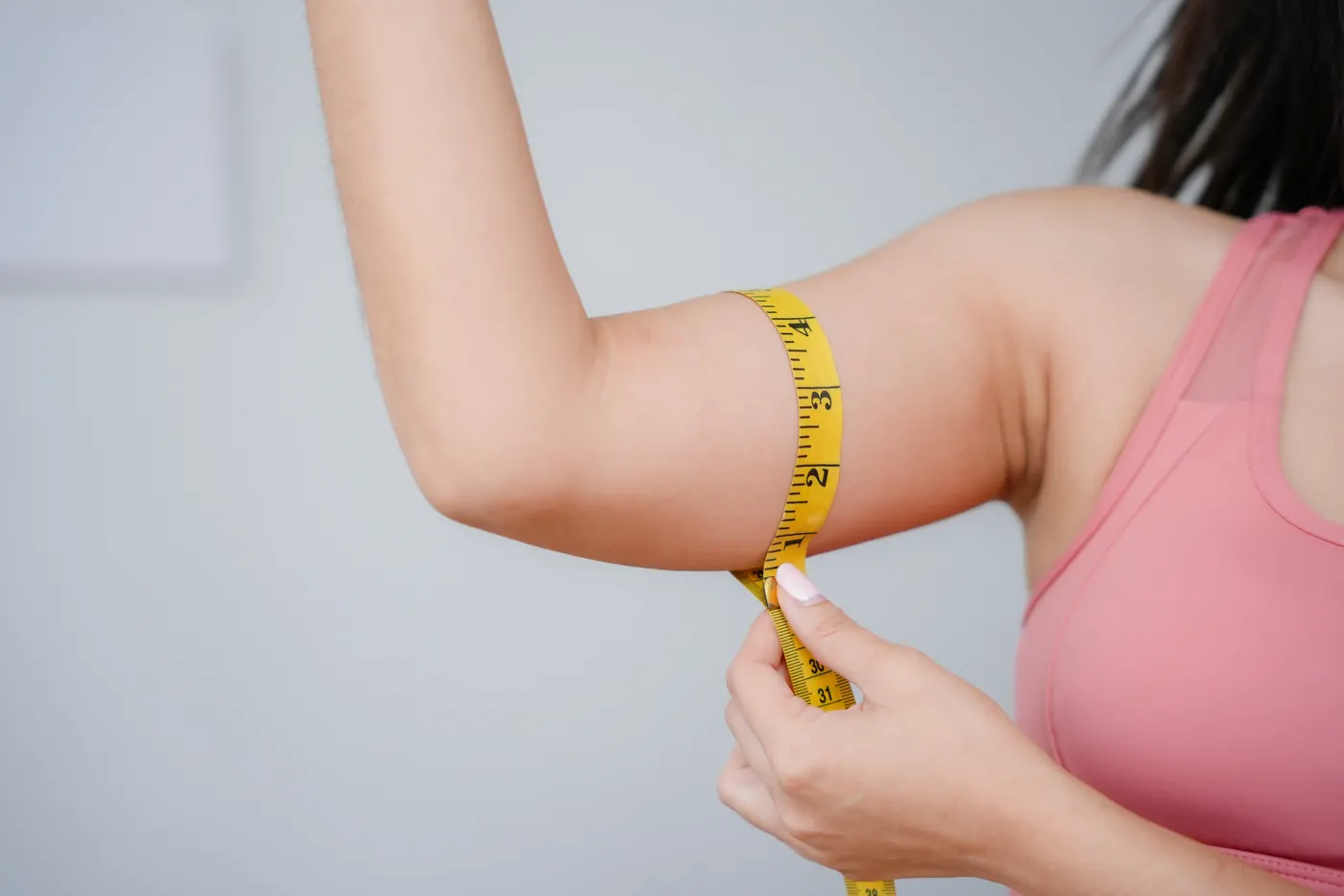 Arm lipo evaluation with Dra. Sofía Rincón