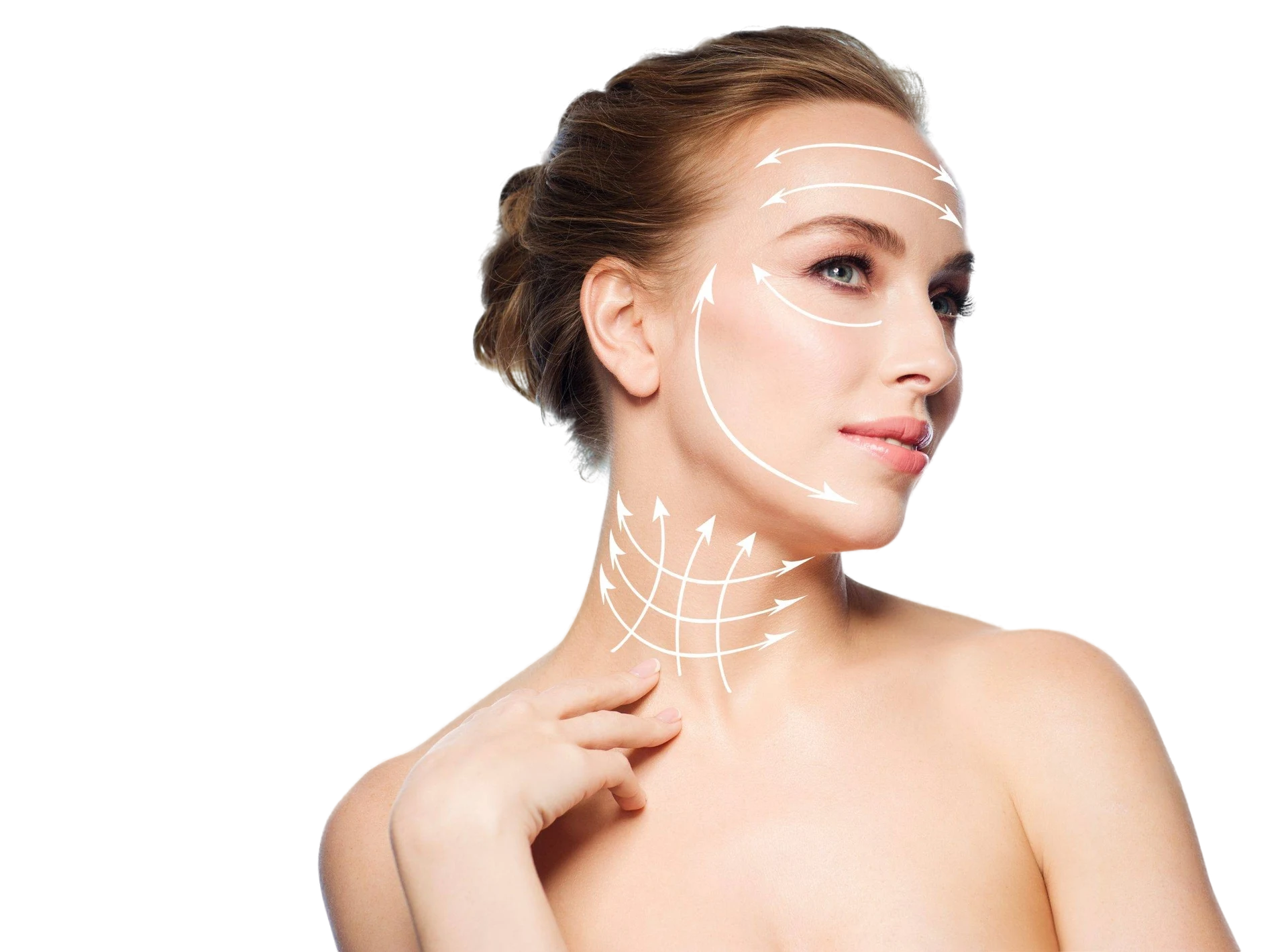 Rostro y cuello con flechas que indican la dirección del lifting (imagen ilustrativa)